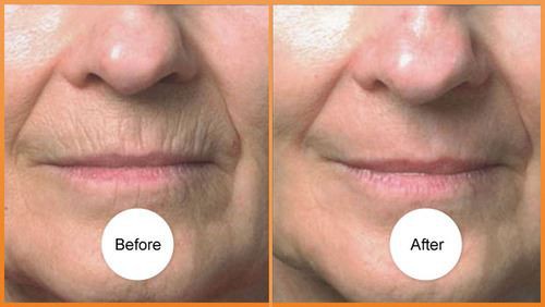 face before after  (1)