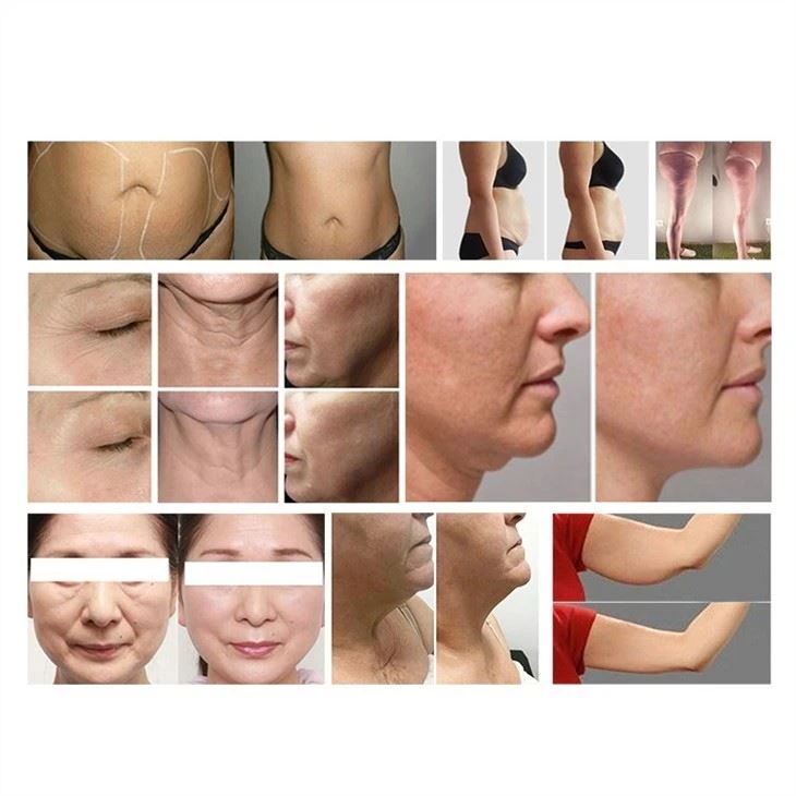 Body Slimming Machine/best Price Good Quality Whole Body Sculpture Sliming Machine