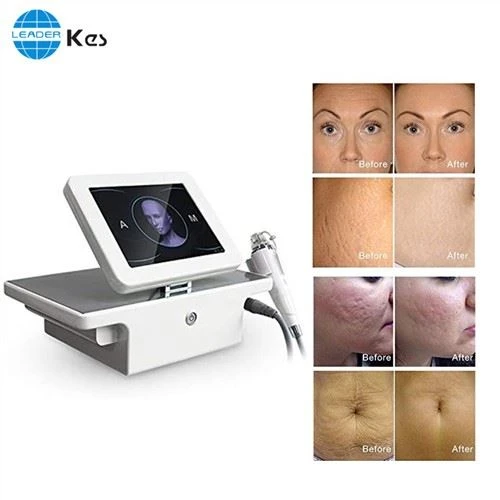 Rf Microneedle Rf Microneedling Machine salong Kasutage kaasaskantavat fraktsioneerivat Rf näo tõstvat mikronõela Equipo