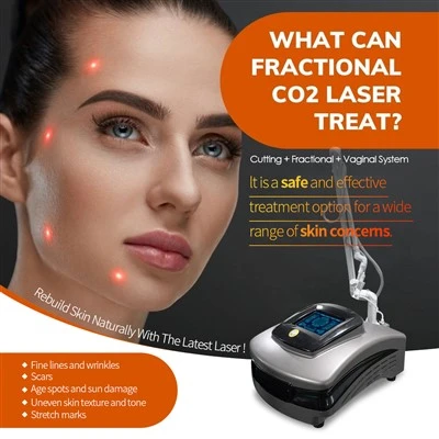 Uusim CO2 lasermasina naha nahk